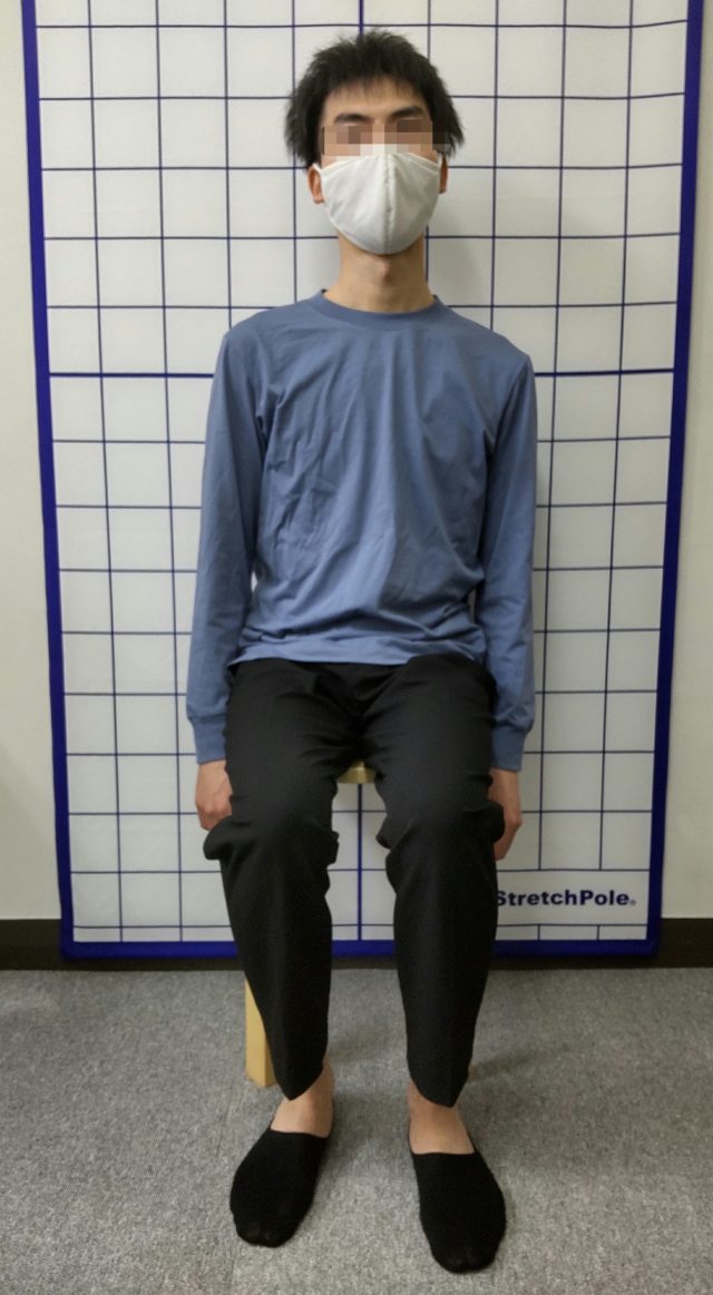 before画像