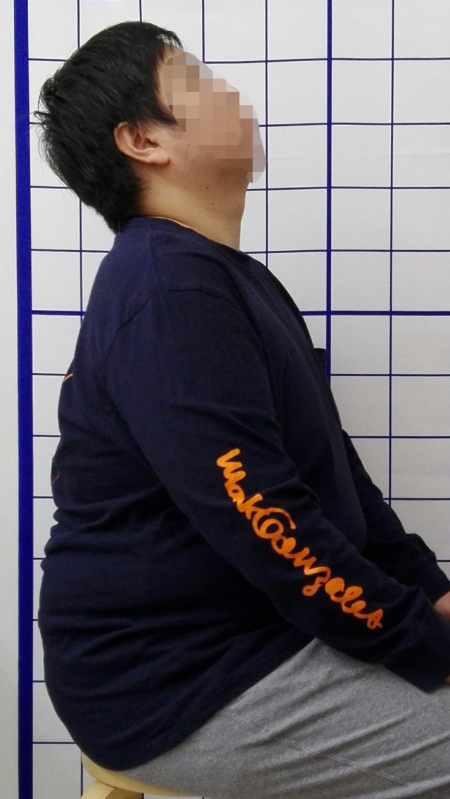 before画像